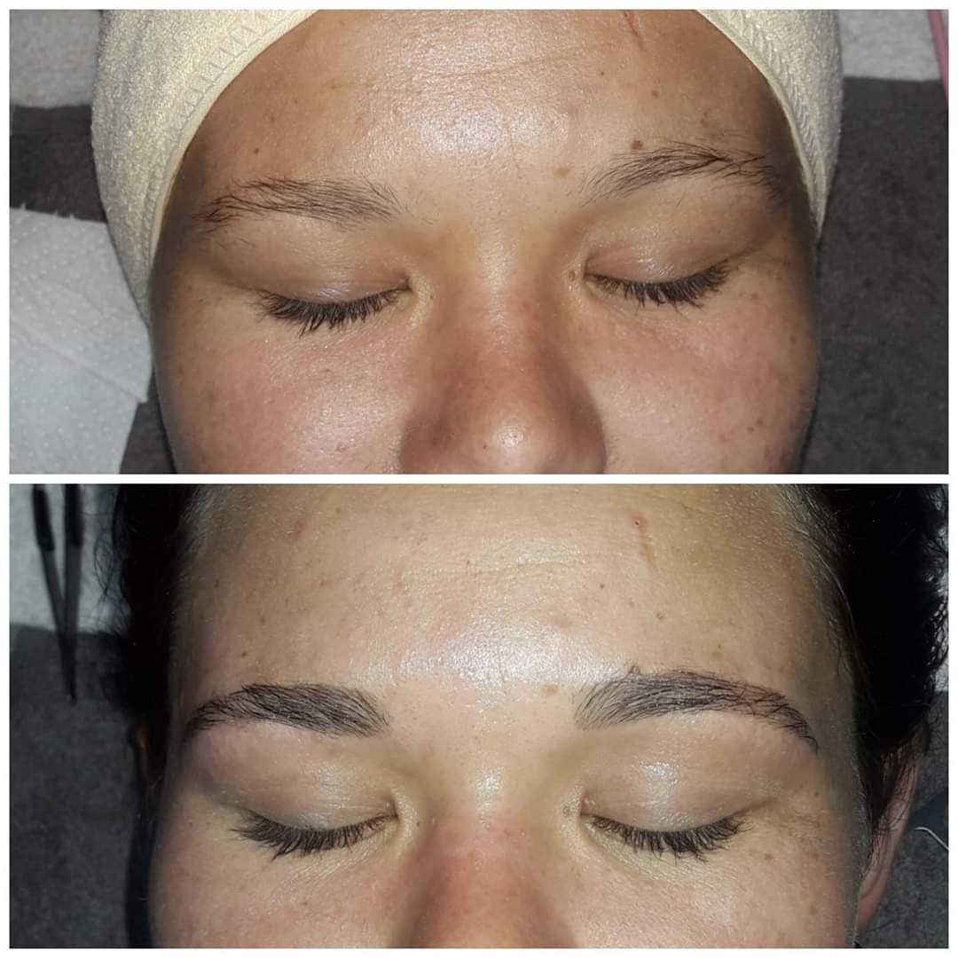 Brow transformation, eyes closed
